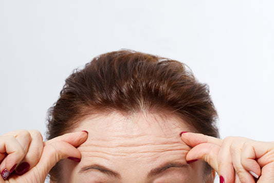 How To Get Rid of Wrinkles on Your Forehead