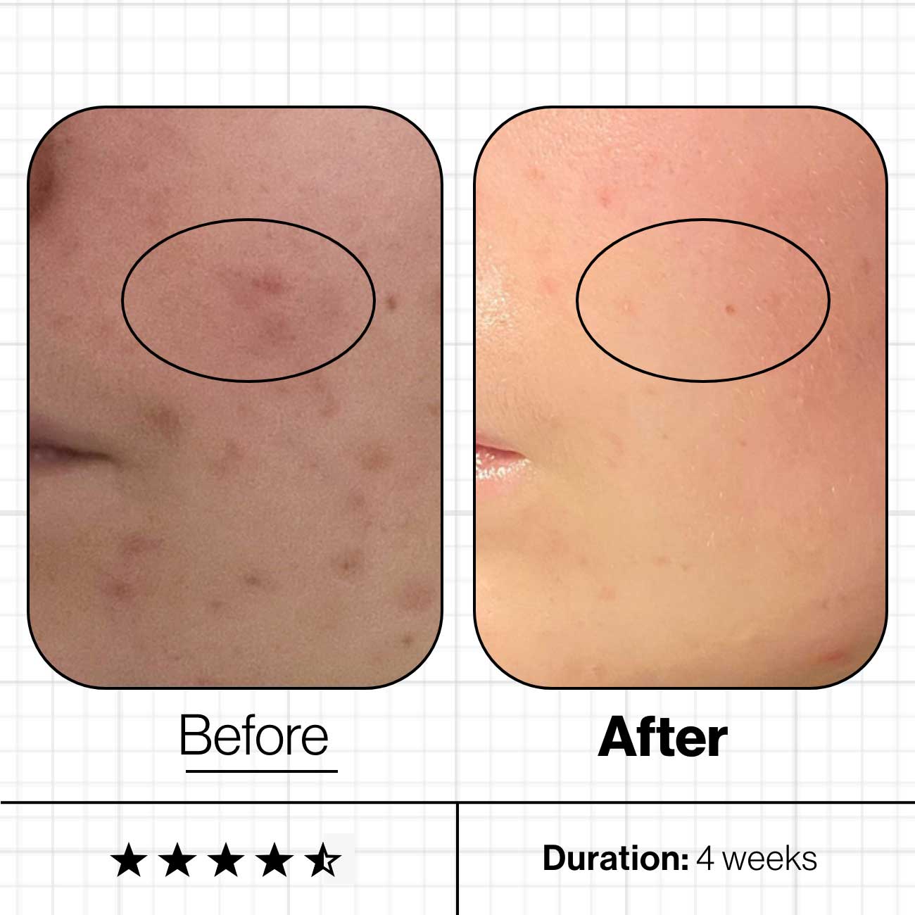 Skin Clear Biome - Advanced Nutrition - Supplements