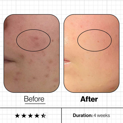 Skin Clear Biome - Advanced Nutrition - Supplements
