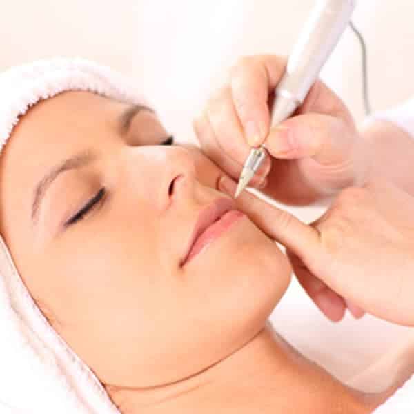 Electrolysis